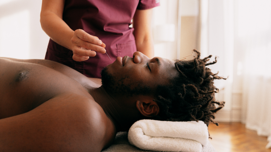 A man relaxes and lies on his back, de-stressing because he's getting acupuncture on his face.
